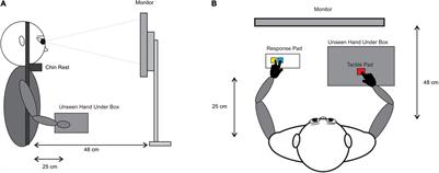 The Role of Awareness on Motor-Sensory Temporal Recalibration